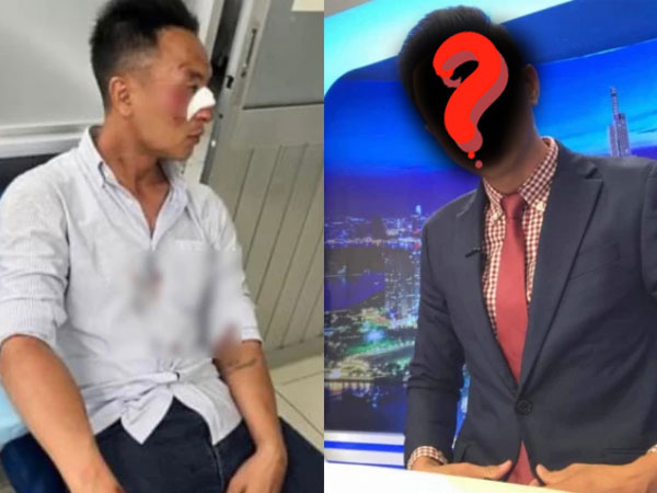 Nam MC nổi tiếng nhập viện vì gặp tai nạn giao thông kinh hoàng