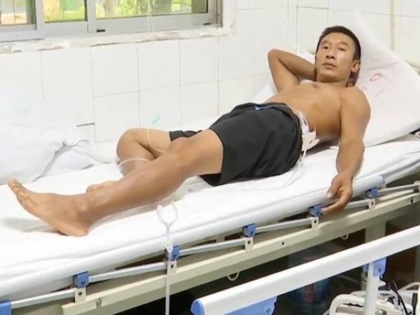 5 phút bị sét đánh 2 lần, người đàn ông sống sót ngoạn mục
