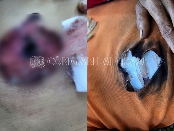 Chồng bắn vợ nhập viện vì không chịu gói bánh cúng rằm