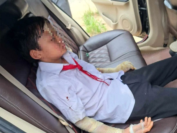 Nổ bóng bay trong lễ khai giảng, nhiều học sinh nhập viện