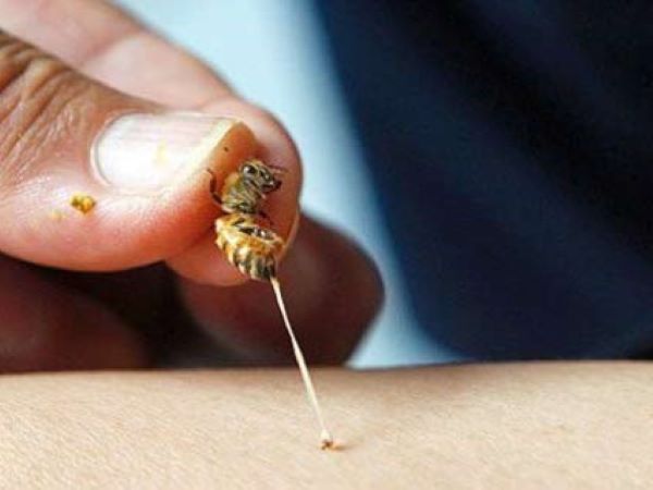 4 mẹ con thương tích nặng vì bị ong vò vẽ đốt