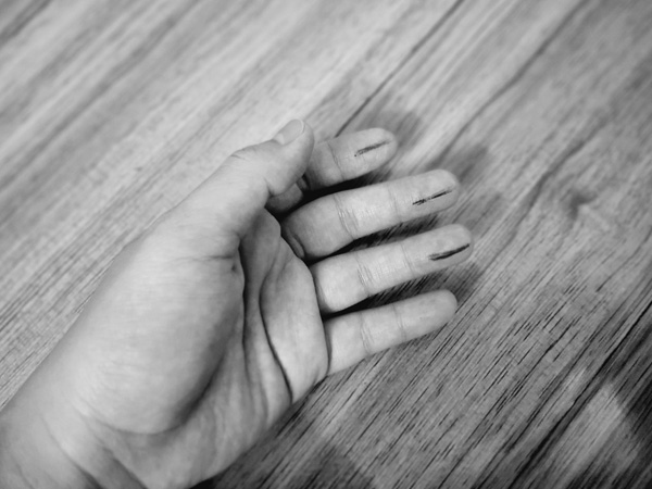 Cách sơ cứu đột quỵ sai lầm nhưng vẫn có nhiều người áp dụng