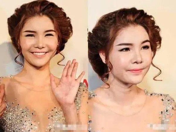 Siêu mẫu Kỳ Hân - vợ Mạc Hồng Quân tiết lộ khủng hoảng vì khuôn mặt biến dạng sau phẫu thuật thẩm mỹ