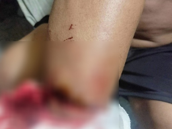 Bắt giữ 2 nghi phạm cướp tài sản rồi kêu bị hại... nấu mì gói cho ăn