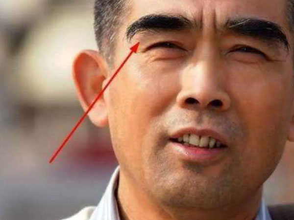 60 tuổi thấy lông mày mọc dài thì mừng vội, cứ tưởng dấu hiệu trường thọ, không ngờ bác sĩ lắc đầu thở dài