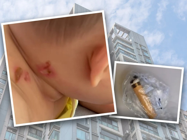 Bé gái 4 tuổi bị thương khiến cảnh sát yêu cầu toàn bộ người dân trong khu chung cư đi xét nghiệm ADN