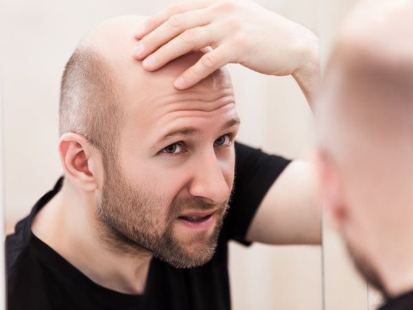 5 cách mọc tóc nhanh cho nam tại nhà siêu đơn giản