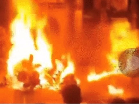 Chơi trò 'phun lửa' đêm Trung thu, 3 cháu nhỏ ở Hà Nội bị bỏng nặng