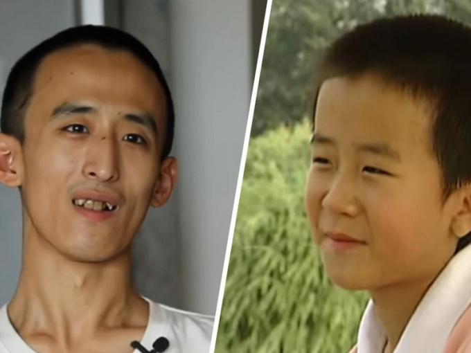 Bi kịch 'sinh viên đại học trẻ nhất Trung Quốc' 28 tuổi vẫn ăn bám bố mẹ, dân mạng tranh cãi kịch liệt