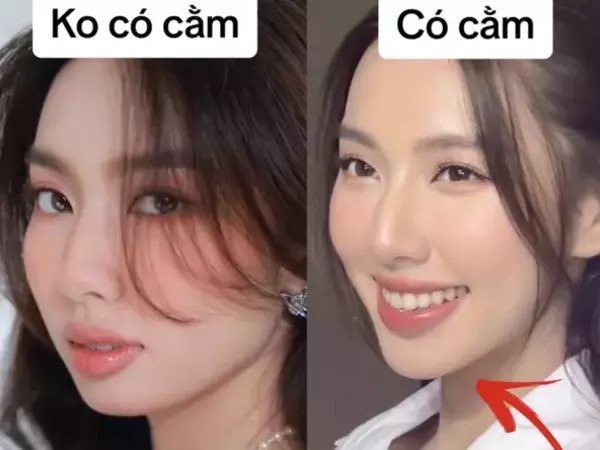 Hoa hậu Thuỳ Tiên vướng nghi vấn 'dao kéo', bị soi điểm khác lạ trên gương mặt