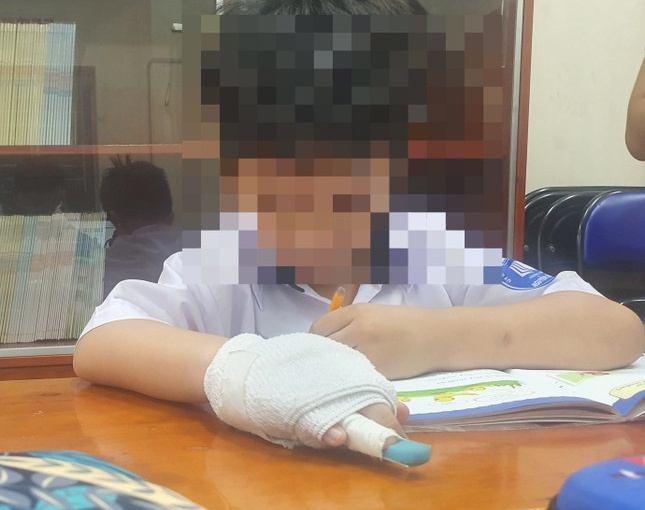 Xử lý nghiêm giáo viên tác động vật lý làm học sinh gãy ngón tay