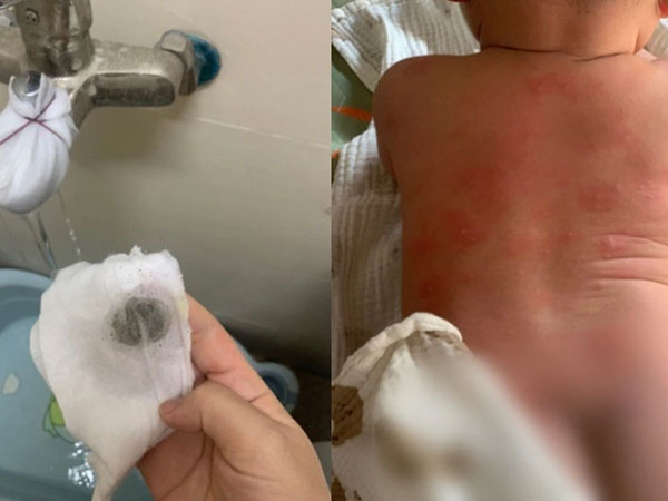 Sở Xây dựng Hà Nội lên tiếng vụ hàng trăm cư dân nổi mẩn ngứa, bong tróc da khi dùng nước sinh hoạt