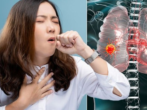 Ai có nguy cơ mắc ung thư phổi?