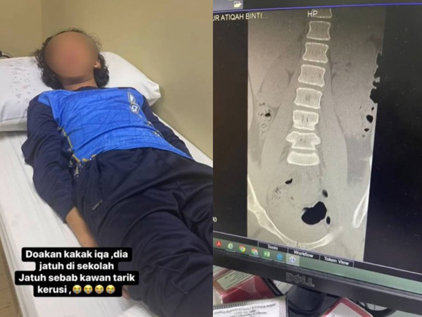 Nữ sinh liệt nửa người sau khi bị bạn cùng lớp trêu bằng trò đùa rất phổ biến