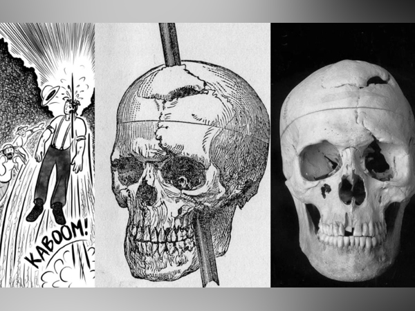 Người đàn ông bị thanh sắt đâm xuyên đầu vẫn sống khỏe nhưng đổi hoàn toàn nhân cách, bí mật khám phá sau đó tạo nên cách mạng ngành y