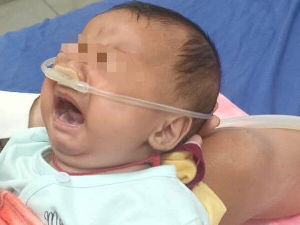 Loại virus lây qua nụ hôn khiến 100 trẻ nhập viện, có bé phải thở máy