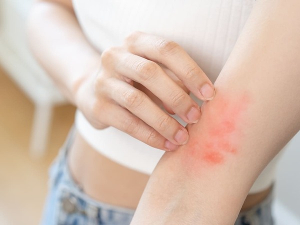Ngứa da sau khi tắm cảnh báo nguy cơ mắc bệnh gì?
