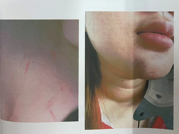 Bị nhóm phụ huynh đánh hội đồng, nữ sinh lớp 12 gửi đơn 'kêu cứu'