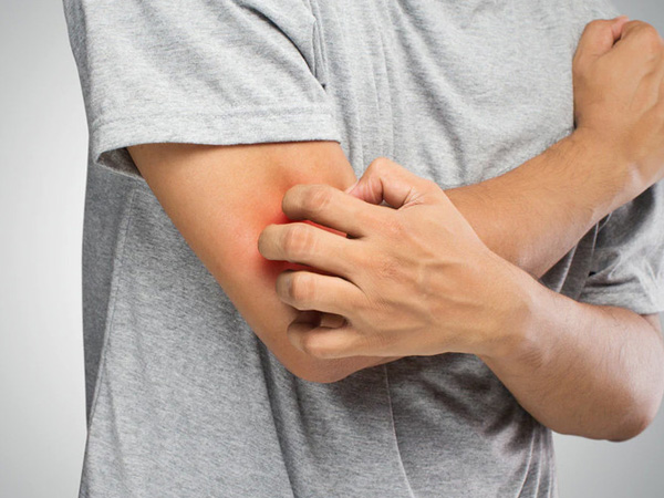 Phân biệt giữa mẩn đỏ thông thường và ung thư da