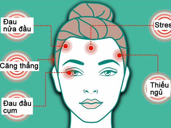 Từng vị trí đau đầu cảnh báo bất ổn sức khỏe khác nhau