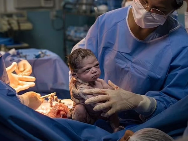 Cuộc sống hiện tại của em bé nổi tiếng khắp thế giới vì lườm bác sĩ lúc chào đời
