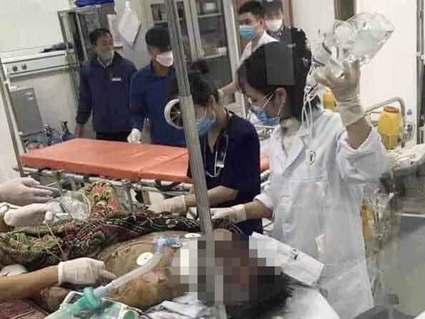 Nam sinh lớp 11 bị thương nặng vì học cách chế pháo nổ trên mạng