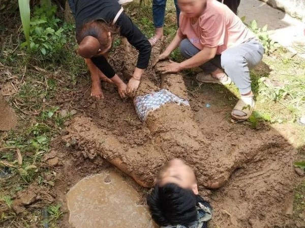 Em lao vào cứu anh trai bị điện giật, cả 2 bị thương nặng