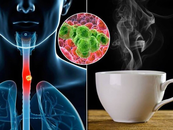 Tiến sĩ Anh cảnh báo loại đồ uống có thể làm tăng 79% nguy cơ mắc ung thư, mùa đông nên cẩn trọng