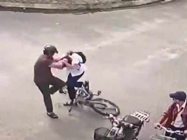 Vụ nam sinh lớp 9 bị bố bạn đánh: Tổn thương nội sọ, chấn thương quai hàm