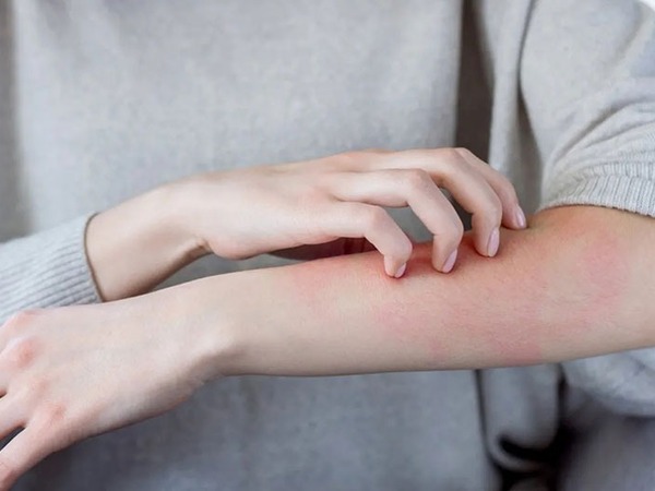Vì sao hay ngứa da vào mùa lạnh?