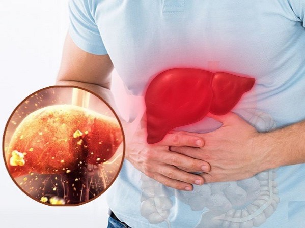 Gan sợ nhất 5 thứ, càng ăn nhiều tuổi thọ càng bị rút ngắn: Ai cũng biết nhưng vẫn chủ quan