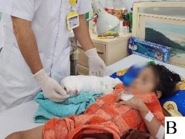 Bé gái 5 tuổi đứt lìa cánh tay vì tay áo bị cuốn vào bánh xe máy