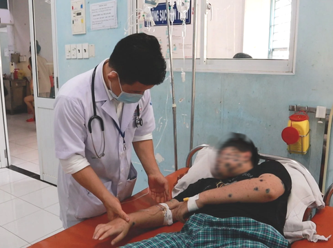 Bệnh thủy đậu vào mùa, những điều bậc cha mẹ cần lưu ý