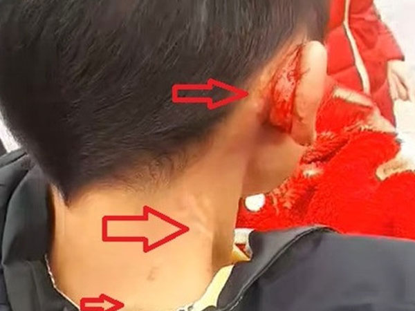 Mẹ bạo hành con giữa đường gây phẫn nộ: 'Cháu bị đánh là có lý do'