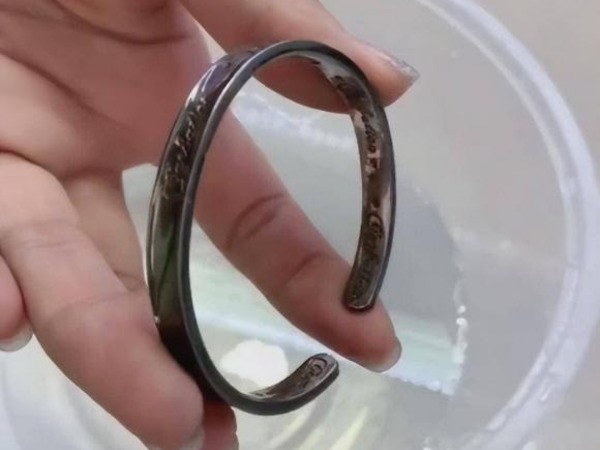 Vòng tay bạc chuyển sang màu đen, có phải nó đang hấp thụ chất độc ra khỏi cơ thể?