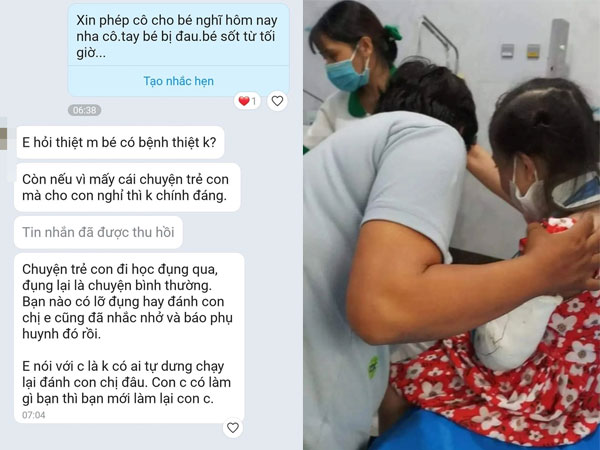 Xôn xao vụ phụ huynh xin cho con nghỉ học vì gãy tay, cô giáo nhắn: Không ưng lớp này thì xin chuyển lớp khác?