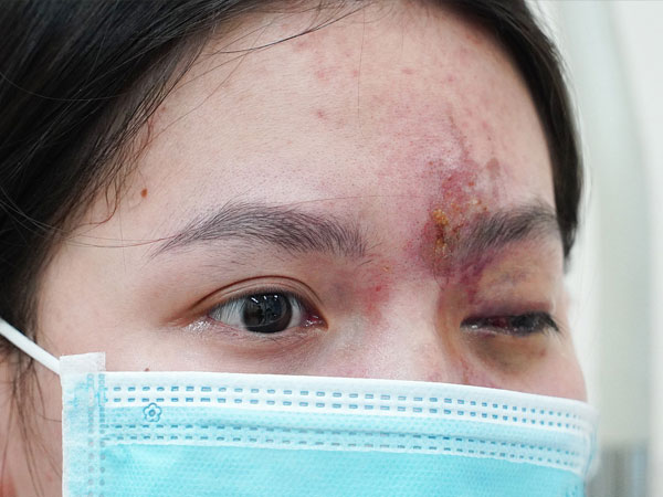 Làm đẹp cuối năm, nhiều người mất Tết vì biến chứng