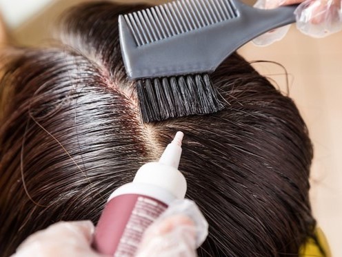 Người phụ nữ hôn mê sau 4 giờ nhuộm tóc và suýt mất mạng, bác sĩ nhắc nhở đối tượng nên cảnh giác khi làm đẹp