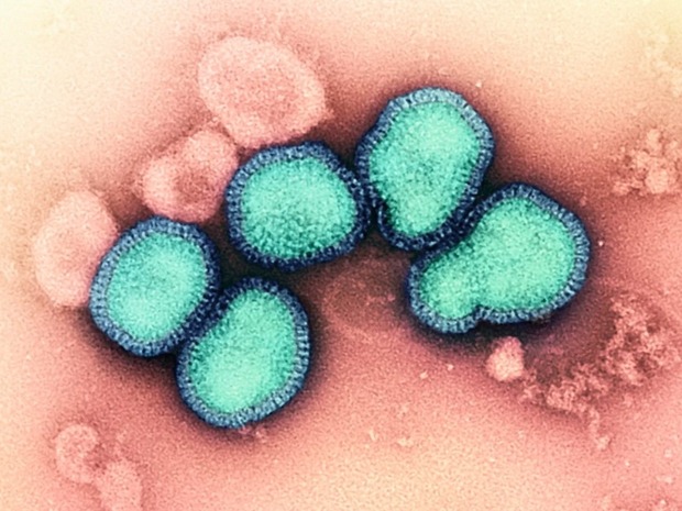 Trung Quốc xuất hiện ca tử vong do nhiễm hỗn hợp virus cúm A/H3N2 và H10N5