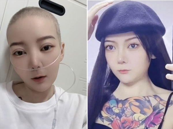 Hotgirl 28 tuổi qua đời vì ung thư thận, trước khi mất nhắn nhủ mọi người đừng làm 2 việc
