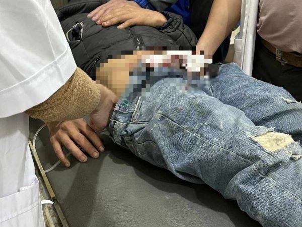 Nam thanh niên chưa vợ tự lấy kéo cắt đứt lìa 'cậu nhỏ'