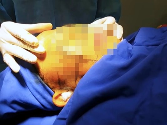 Việt kiều 70 tuổi tử vong bất thường khi đi căng da mặt