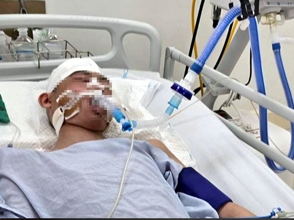 Nam sinh lớp 8 bị đánh chấn thương sọ não: Có phản xạ nhẹ, chưa rõ tiên lượng