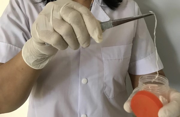 Kéo từ đùi ra một 'sợi dây' màu trắng dài cả chục cm, người đàn ông đi khám, giật mình vì nguyên nhân