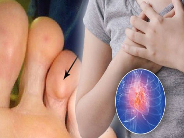 3 dấu hiệu đáng kinh ngạc ở chân cảnh báo một căn bệnh giết người thầm lặng