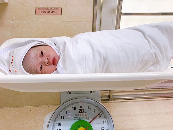 Em bé chào đời với dây rốn quấn cổ 5 vòng hiếm gặp