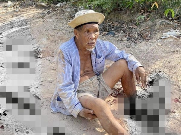 Điều tra vụ cụ ông 85 tuổi bị dập nát 2 bàn chân