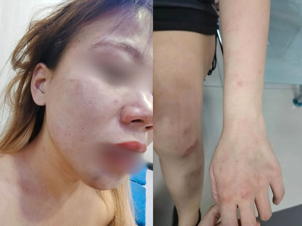 Bị chồng bạo hành dã man, vợ gọi cho người yêu cũ để cầu cứu và cái kết bất ngờ gây xôn xao dư luận