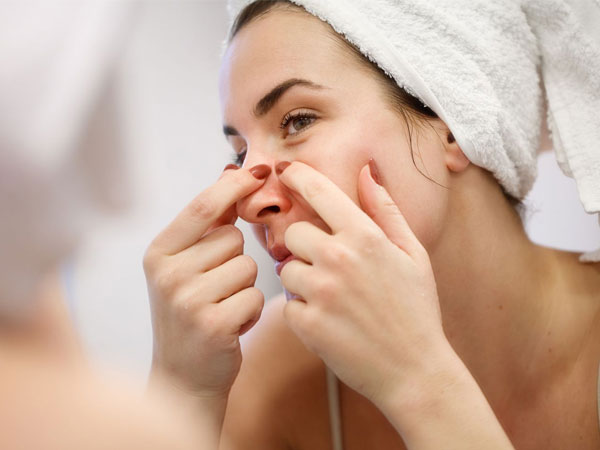 Mụn đầu đen và 6 thói quen sai lầm cần tránh khi chăm sóc tại nhà
