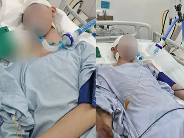 Tình hình nam sinh lớp 8 bị bạn học đánh chấn thương sọ não nguy kịch hiện tại ra sao?